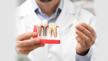Understanding the Risks if You Smoke with Dental Implants: Navigating the Perils